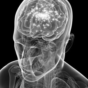 Brain-Epilepsy-300x300